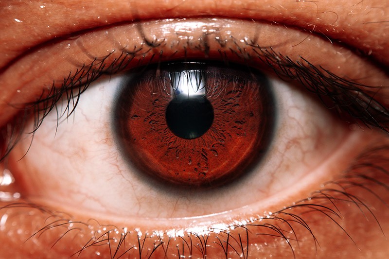 ojo-rojo